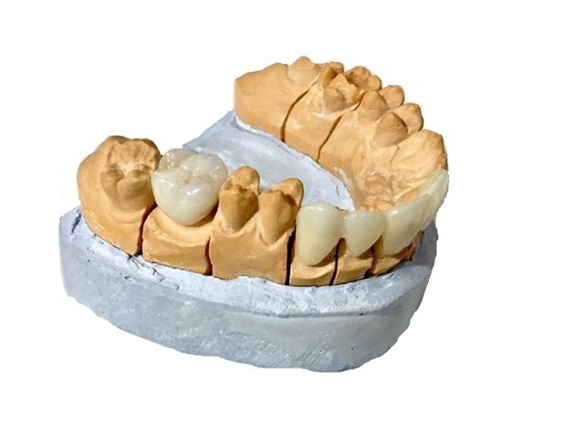 MONOLITICA (glaseada)