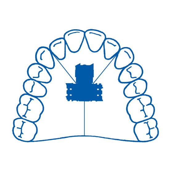 TORNILLO TRIDIMENSIONAL SUP LEONE