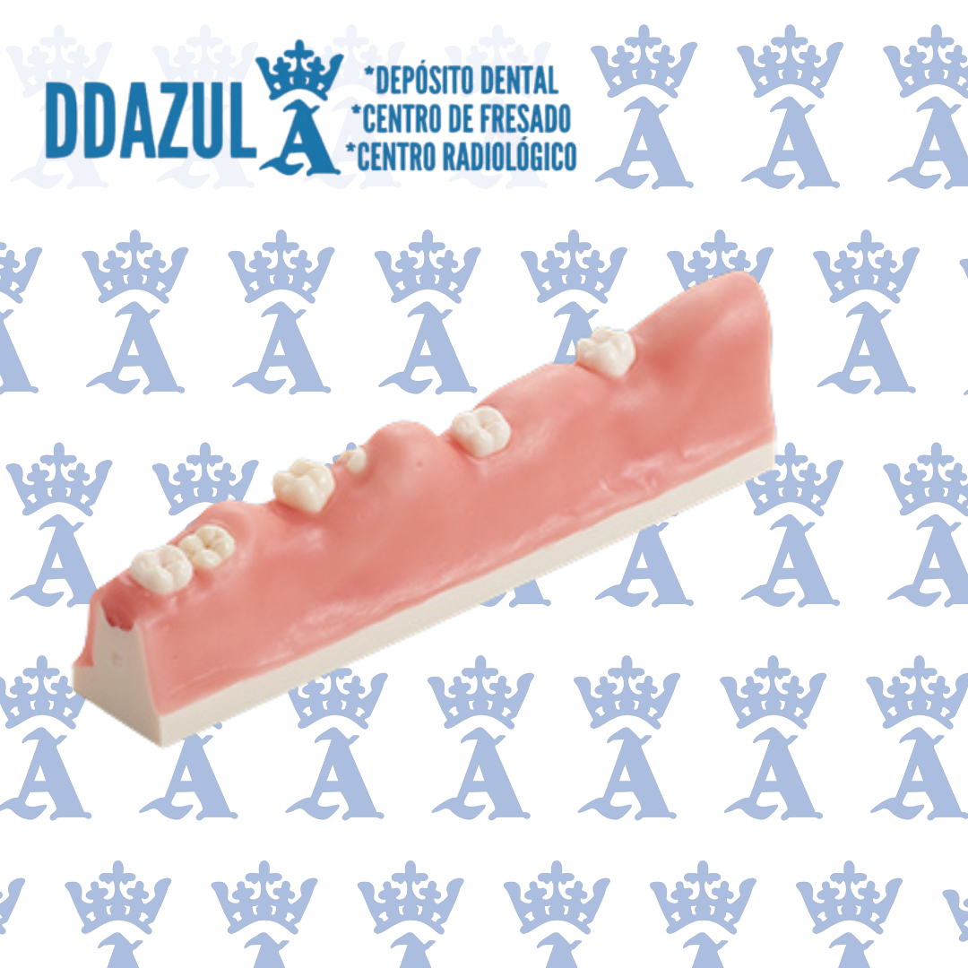 MODELO P/EXTRACCION DIENTE IMPACTADO NISSIN